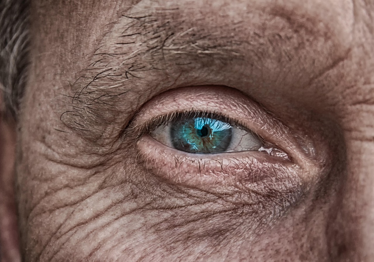 Morpheus8 for Wrinkles in Decatur, GA: The Ultimate Guide